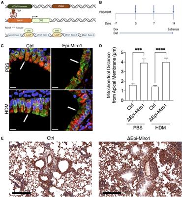 Deletion of Miro1 in airway club cells potentiates allergic asthma phenotypes